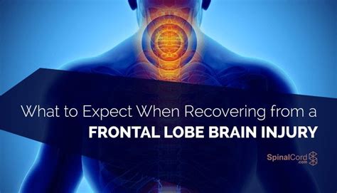 Damage to the Frontal Lobe of Brain from Concussion : PostConcussion