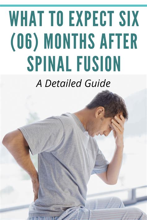 What To Expect Six 06 Months After Spinal Fusion A Detailed Guide Artofit