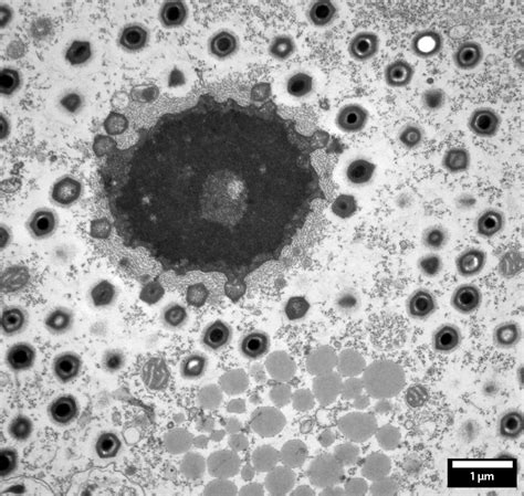 Acanthamoeba Polyphaga Mimivirus Delong America