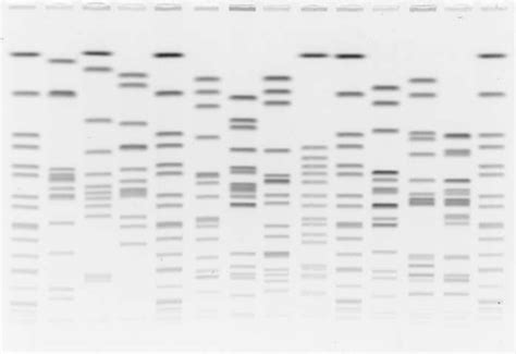 Gel with high scores in all seven PFGE gel quality parameters ...