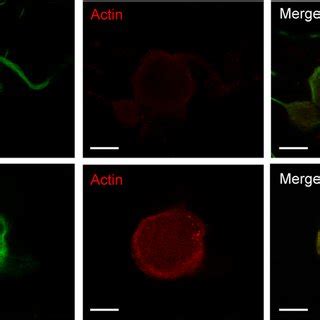 A Confocal images of double immunostaining with anti βIII tubulin