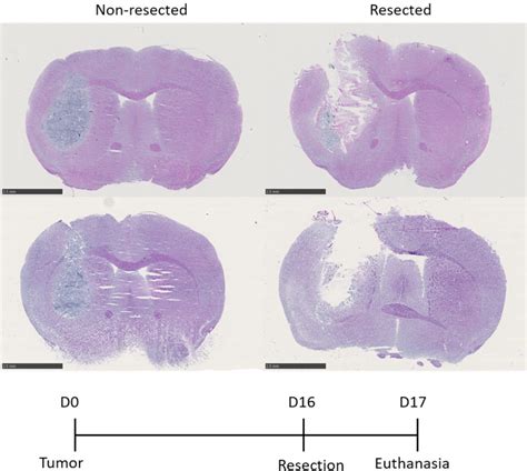 Resection Of Orthotopic Murine Brain Glioma