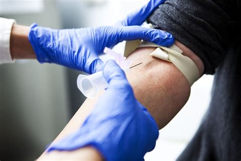 CO2 Blood Test to Check Carbon Dioxide Levels