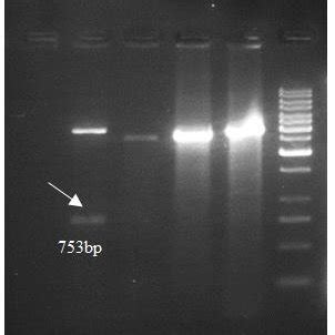 Double Digestion Of Plasmid Results With Bamhi And Xhoi After Cloning