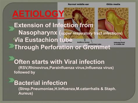 Types Of Otitis Media By Dr Haseeb Ahmed Dec 2011 Ppt