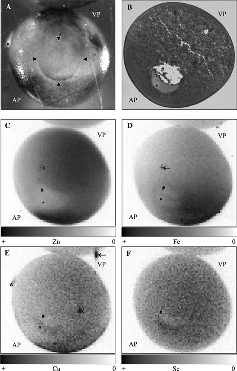 Elemental Mapping Of The Xenopus Laevis Oocyte The Oocyte Is Oriented