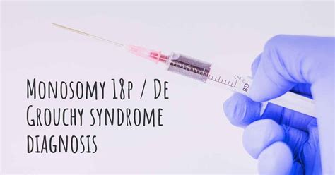 How Is Monosomy 18p De Grouchy Syndrome Diagnosed