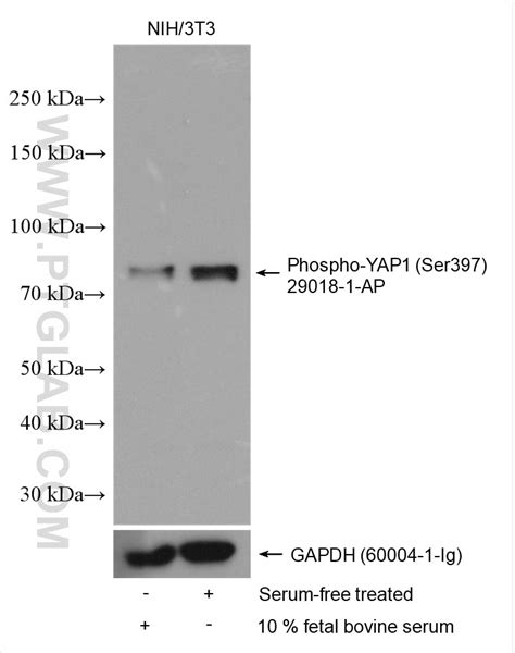 Phospho YAP1 Ser397 Antibody 29018 1 AP Proteintech