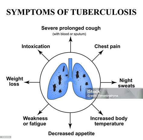 Gejala Tbc Hari Tuberkulosis Sedunia 24 Maret Struktur Paruparu