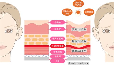 たるみ治療 ツツイ美容外科・美容皮膚科（大阪・心斎橋）