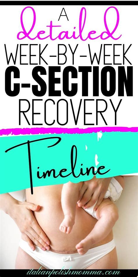 C Section Recovery Timeline Artofit