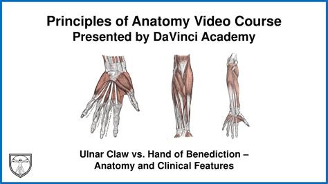 Ulnar Claw Vs Hand Of Benediction Anatomy And Clinical Features