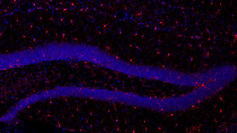 Brain cells called microglia eat away mice’s memories