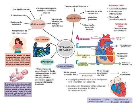 Tetralogía de fallot Estenosis pulmonar Aorta ascendente 1 L de