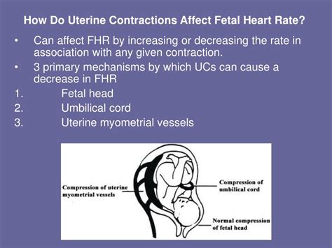 Ppt Basic Fetal Monitoring Review Powerpoint Presentation Free Download Id6960616