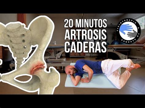 Artrosis De Cadera Fisioterapia A Tu Alcance