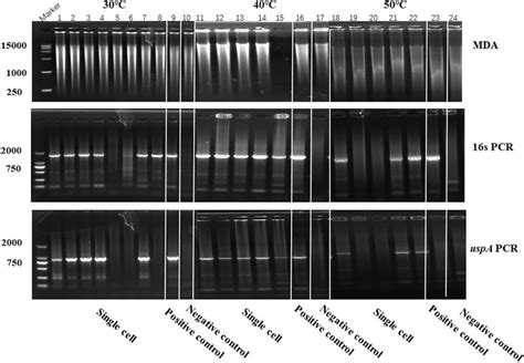 Frontiers Improved Single Cell Genome Amplification By A High