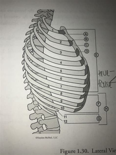 Lateral View Of Rib Cage Diagram Quizlet