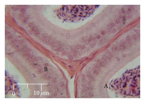 Photomicrograph Of The Cauda Epididymis Showing The Mucosa Lined By