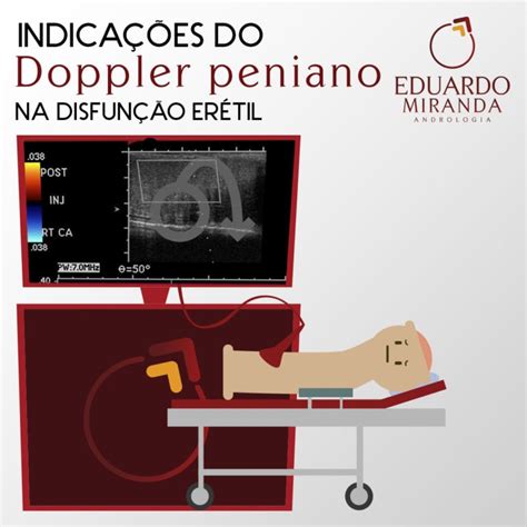 Indicações do Doppler peniano na disfunção erétil Dr Eduardo Miranda