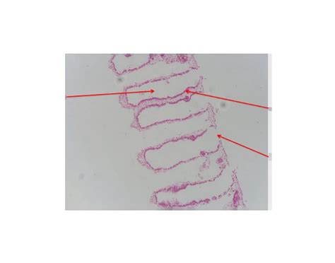 Anatomy of Porifera Quiz