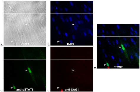 Primary Fibroblast Cultures Show U I Cells With Phosphorylation And