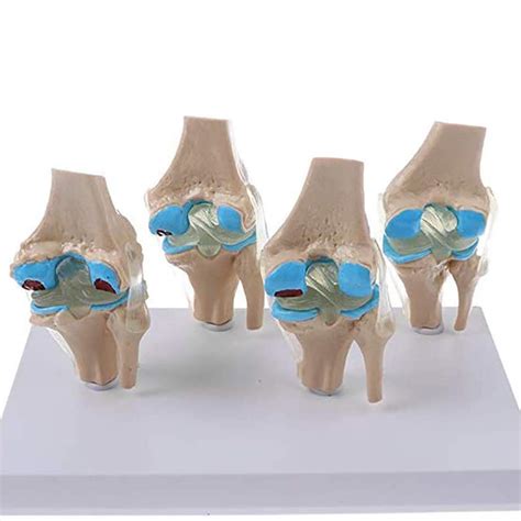 Buy Knee Joint Model Set Human Body Anatomy Replica Set Of Stage