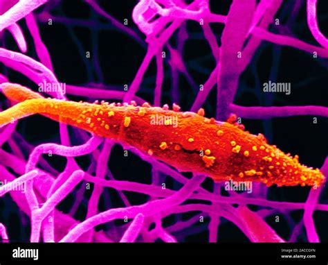 False Color Scanning Electron Micrograph SEM Der Pilz Microsporum