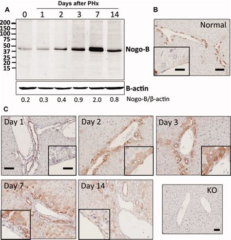 Reticulon B Nogob Facilitates Hepatocyte Proliferation And Liver