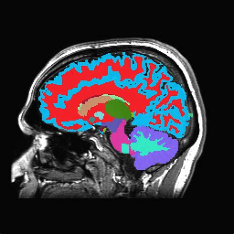 How Exercise Boosts Your Mood and Brain Power