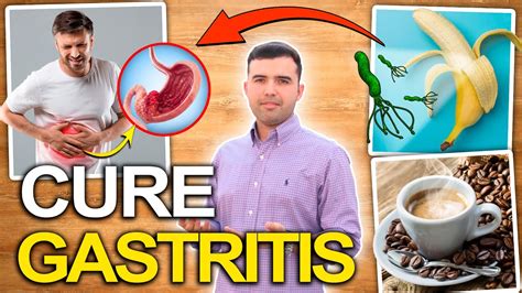 Cure Gastritis Naturally 5 Natural Ways To Eliminate Gastritis Youtube