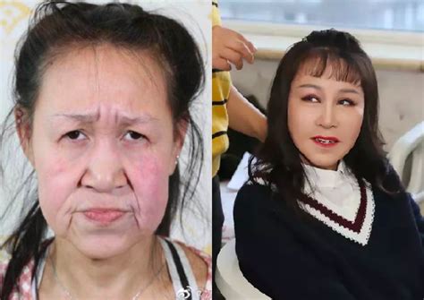 15 Year Old Chinese Grandma Gets Plastic Surgery To Look Her Age