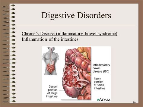 Digestive Disorders