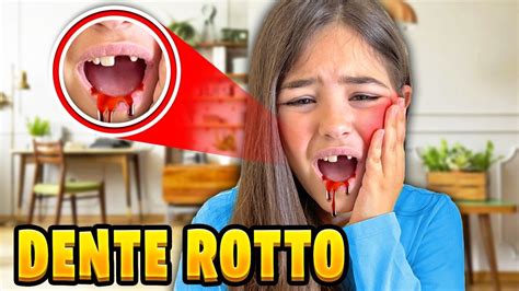 Giulia Si Rotta Il Dente E Si Fa Male E Esce Tanto Sangue E Finisce