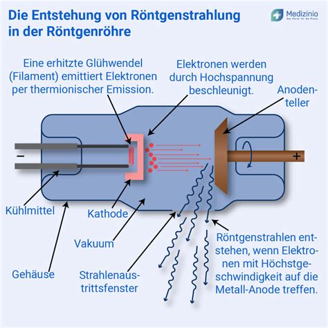 Röntgen Strahlenschutz in der Medizin Personal Patienten