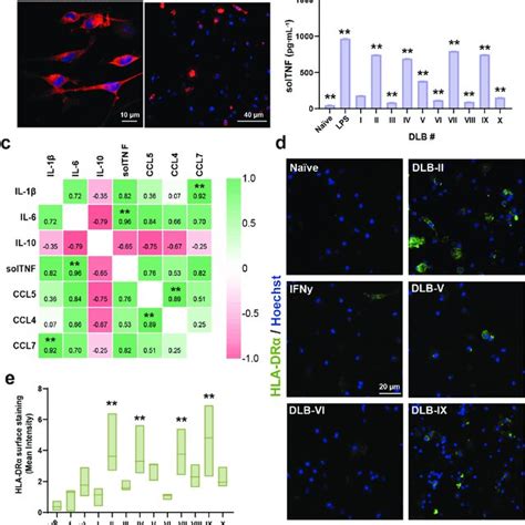 Different Dlb Csf Amplified α Synuclein Fibril Mixtures Cause