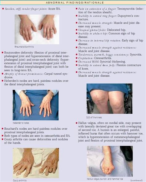 25 Musculoskeletal System Disorders Musculoskeletal System Nursing