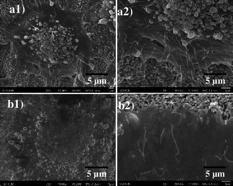 SEM Images Showing Attachment Of Osteoblast Cells On HAp T ZrO 2