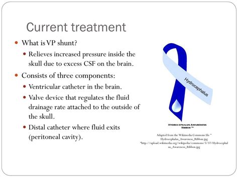 PPT - Hydrocephalus PowerPoint Presentation, free download - ID:2870390