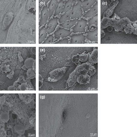 Key Virulence Factors Of Entamoeba Histolytica Involved In Pathogenic