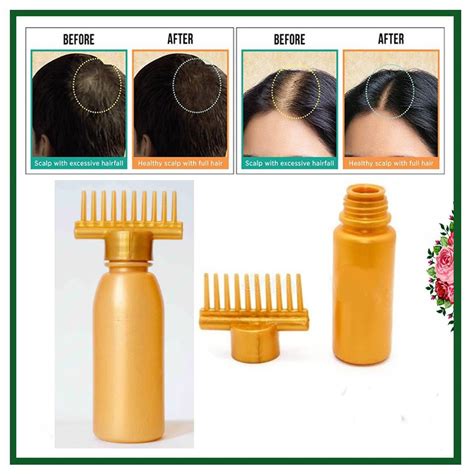 Hair Oil Applicator Comb Root Comb Applicator Bottle 130ml Bhmart