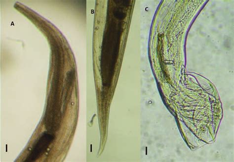 Oesophagostomum Venulosum A Anterior End B Tail Of Female C Tail