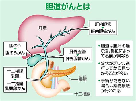 胆道がん治療 選択肢広がる抗がん剤3剤の同時投与も有効 ヨミドクター読売新聞