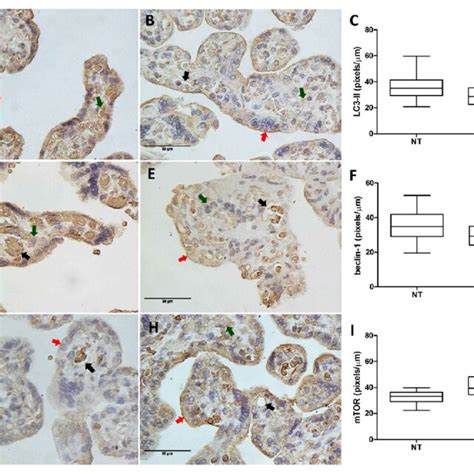 Immunohistochemical Staining And Quantitative Analysis Of LC3 II A B