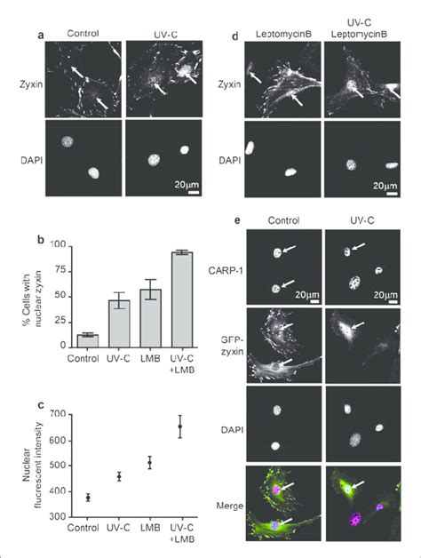 Zyxin Transits To The Nucleus In Response To UV Irradiation A