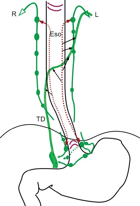 Anatomy of lymphatic drainage of the esophagus and lymph node metastas ...