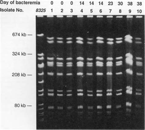 Pulsed Field Gel Electrophoretic Profile Of Smal Digests Of Chromosomal