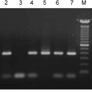 Leishmania Donovani Kinetoplast DNA Specific PCR Products 385 Bp