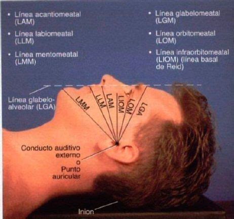 Anato Exam 2 Cabeza Y Cuello Flashcards Quizlet