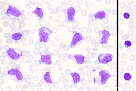 Index Demo Sites Hematomorphology A Databank Imagebank For